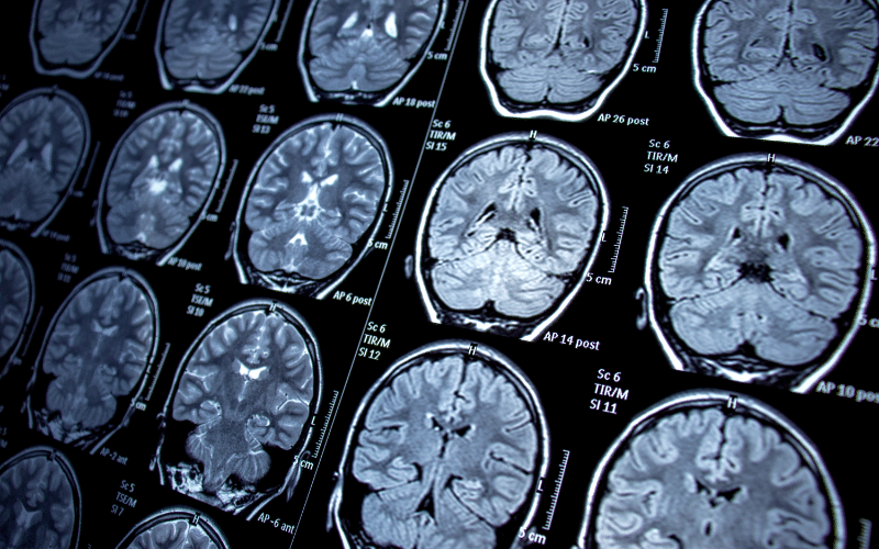 Frequently Asked Questions About Concussions