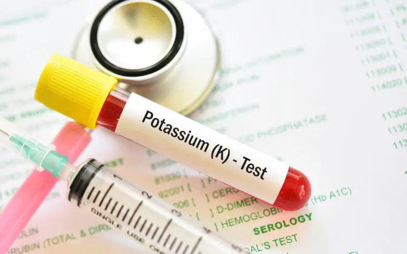 Navigating Hypokalemia- A Deep Dive into the Top 13 Causes of Low Potassium