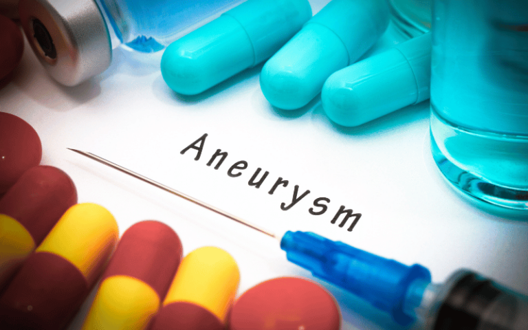 10 Brain Aneurysm Symptoms: Essential Signs of Cerebral Aneurysm You ...