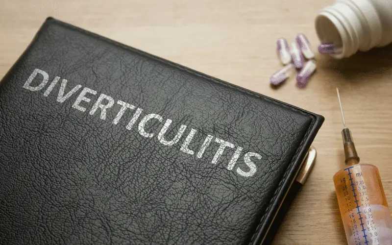 20 Diverticulitis Symptoms You Need to Know About