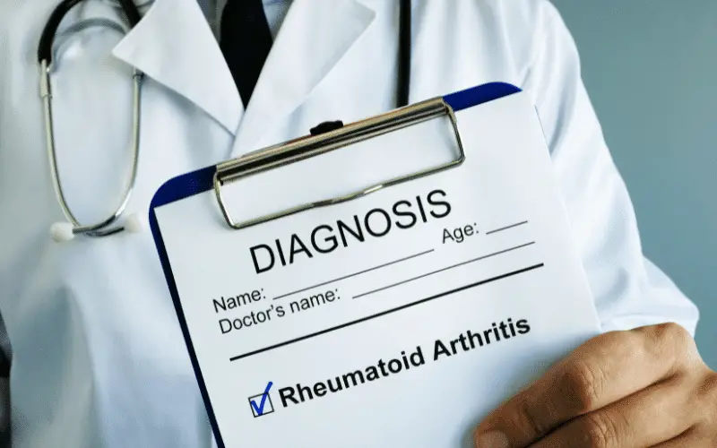Top 10 First Symptoms of Rheumatoid Arthritis Recognizing the Early Signs