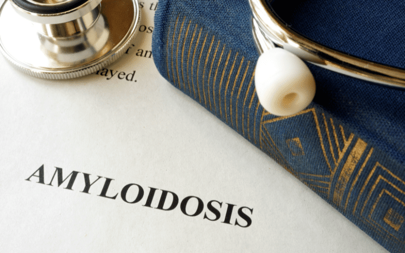 Understanding Amyloidosis Top 20 Symptoms You Should Know