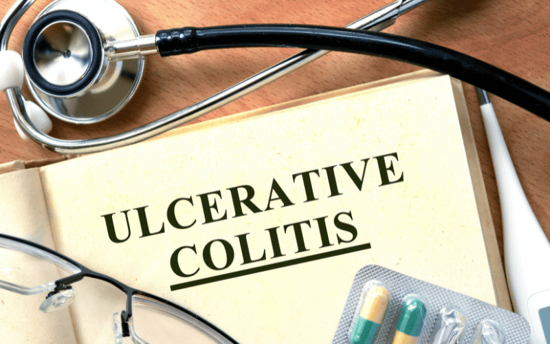 Unmasking Ulcerative Colitis 20 Warning Signs You Shouldn't Ignore