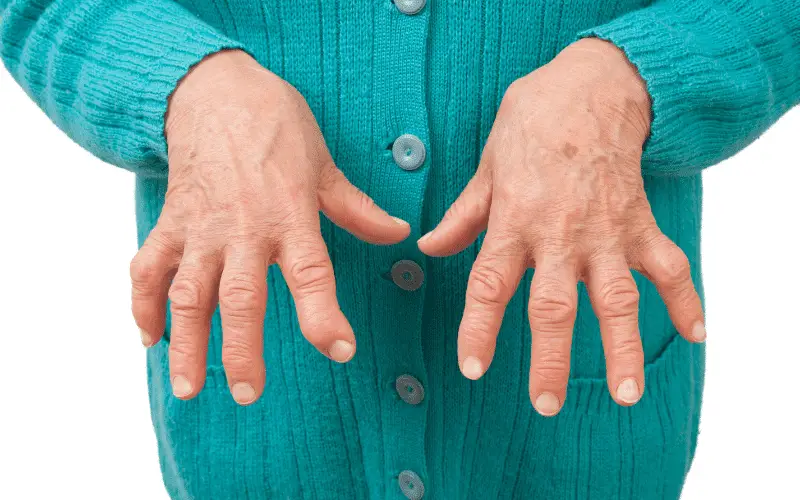 Rheumatoid Arthritis Inflammation Gone Awry