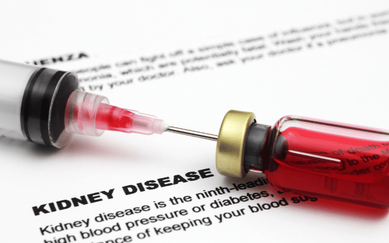 Kidney Disease and Dialysis-Related Amyloidosis The Burden of Kidney Failure on the Body's Protein Balance