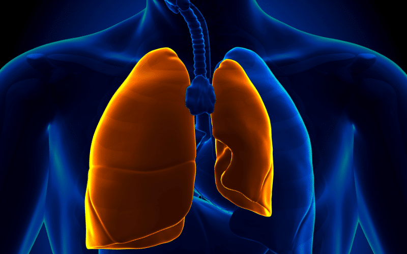 Lung Problems The Respiratory Hurdles Faced by Marfan Syndrome Patients