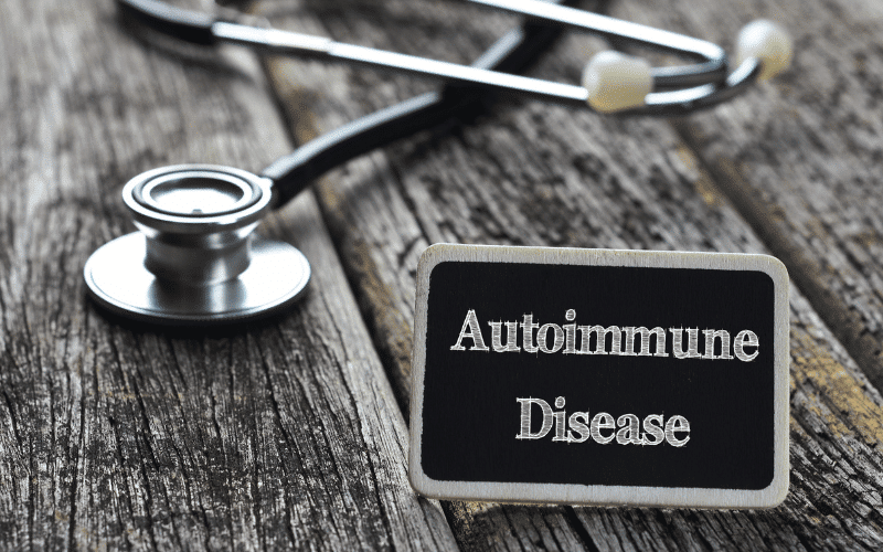 Autoimmune Diseases and the Onset of Amyloidosis The Immune System's Role in Protein Accumulation