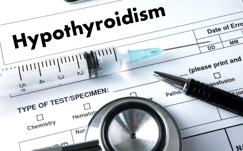 Hypothyroidism The Metabolic Road to Hyponatremia