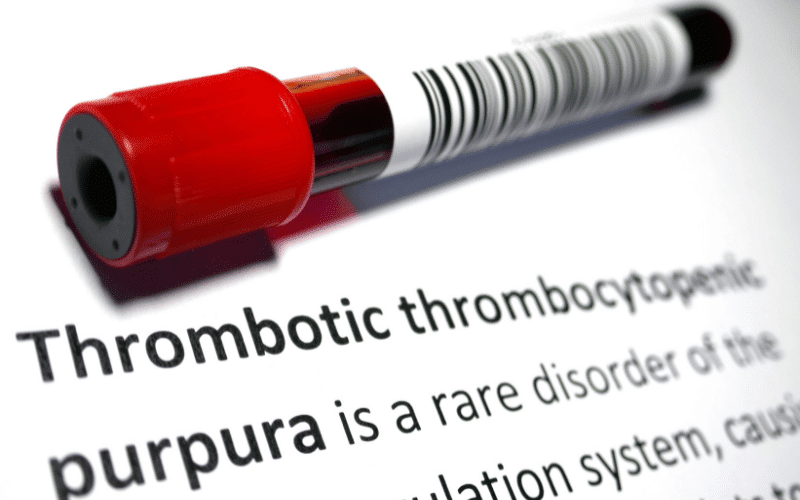 Skin Changes Subtle Indications of Amyloidosis