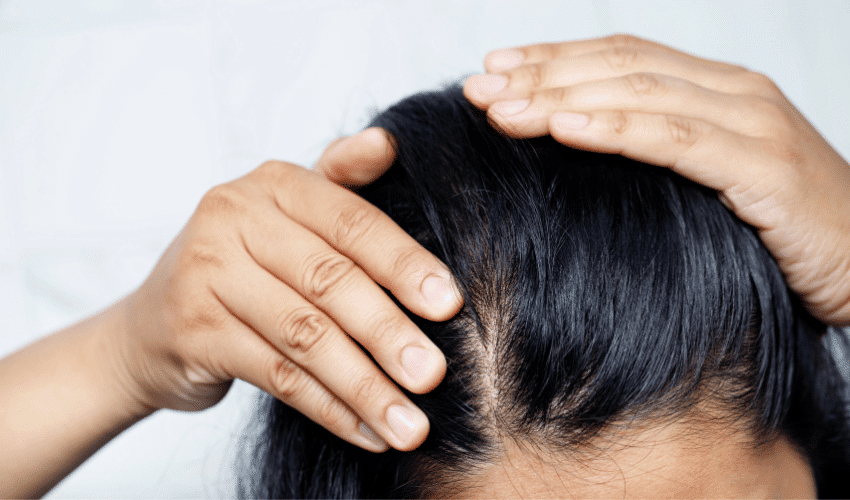 Hair Loss and Brittle Nails The Impact of Grave's Disease on Appearance