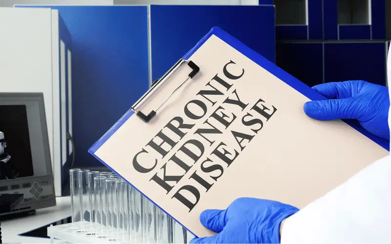 10 Proven Tips to Prevent Chronic Kidney Disease Protect Your Kidneys Today!