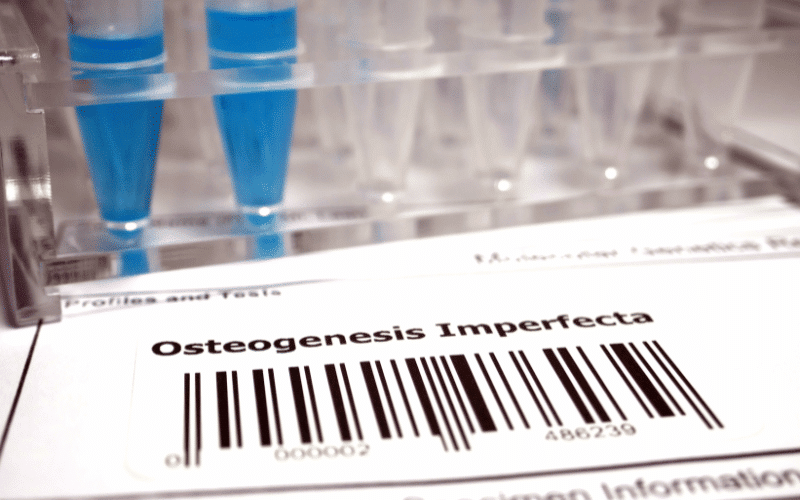 Osteogenesis Imperfecta A Disorder Affecting Bone Strength and Formation