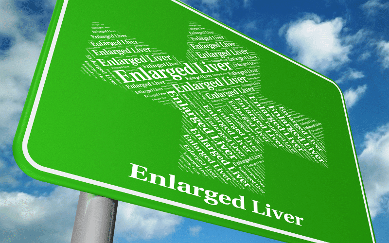 Enlarged Liver The Hepatic Hurdles of Amyloidosis