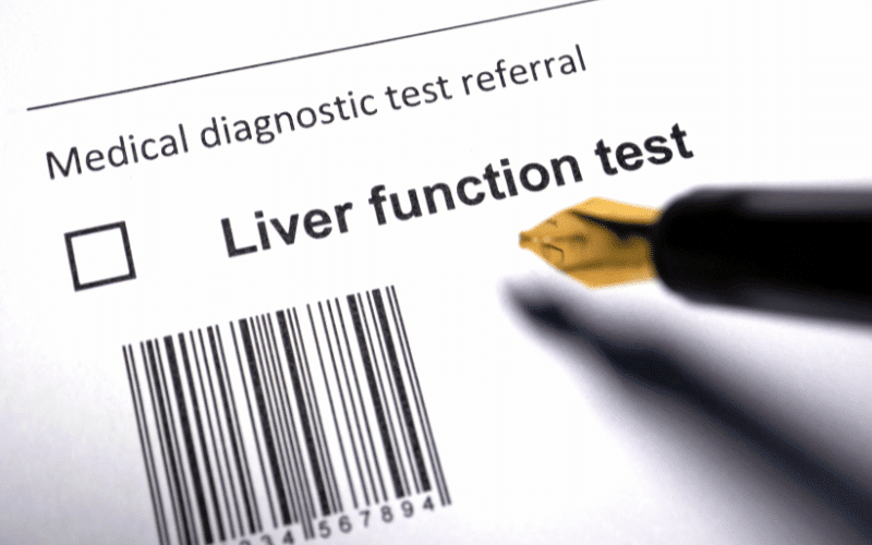 Impaired Liver Function A Possible, but Less Common, Impact of Ulcerative Colitis