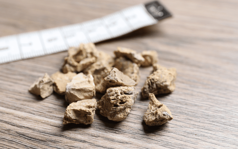 20 Symptoms of Kidney Stones Recognizing the Signs of Nephrolithiasis and Renal Calculi