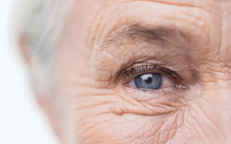 Age-Related Changes to the Vitreous A Natural Part of the Aging Process