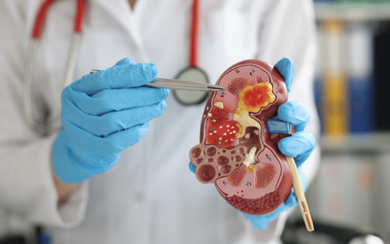 10 Kidney Disease Symptoms You Shouldnt Ignore
