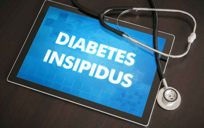 Diabetes insipidus