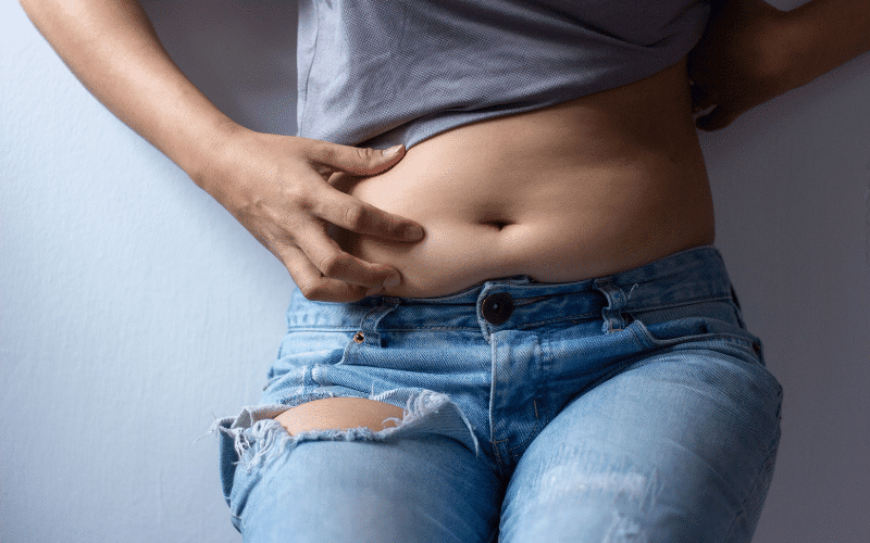 Distended Abdomen A Visible Manifestation of Diverticulosis