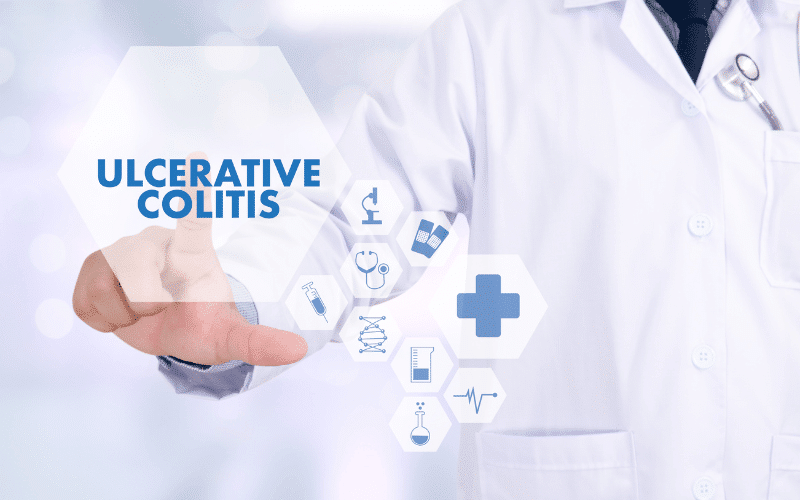 FAQ Recognizing and Managing Early Signs of Ulcerative Colitis