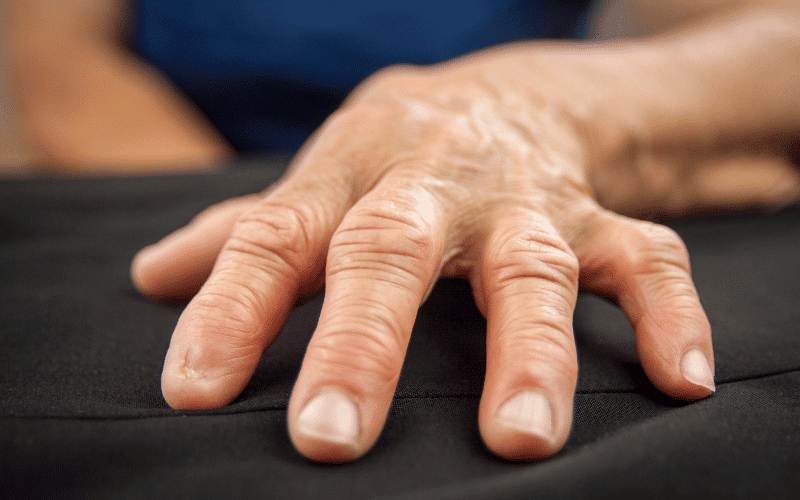 FAQs about Rheumatoid Arthritis Treatment Options