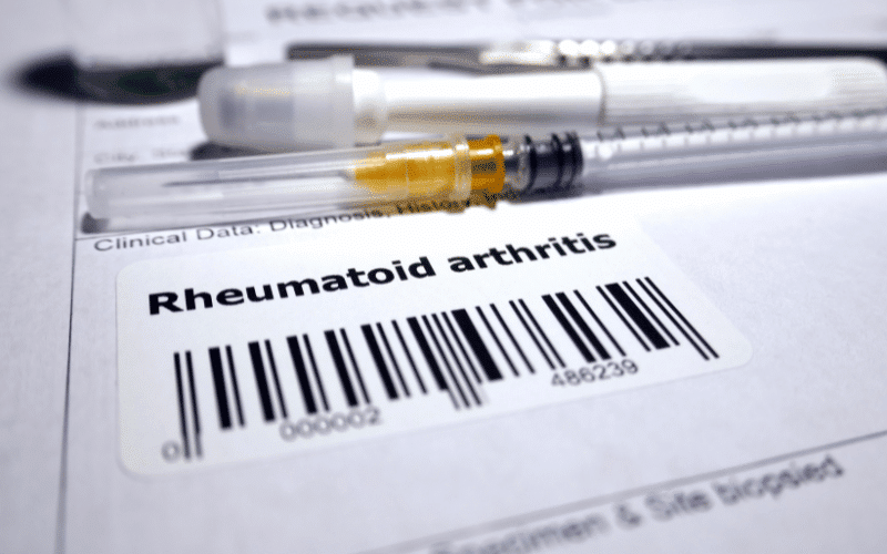 Frequently Asked Questions About Rheumatoid Arthritis Causes