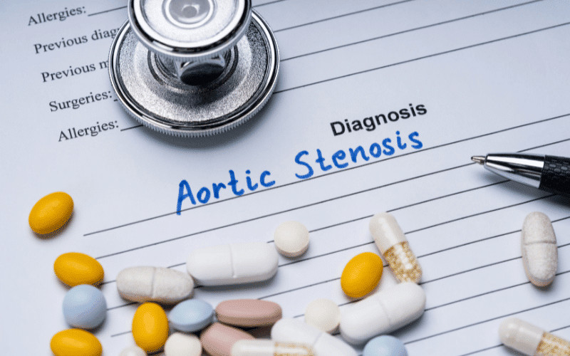 Frequently Asked Questions About Severe Aortic Stenosis