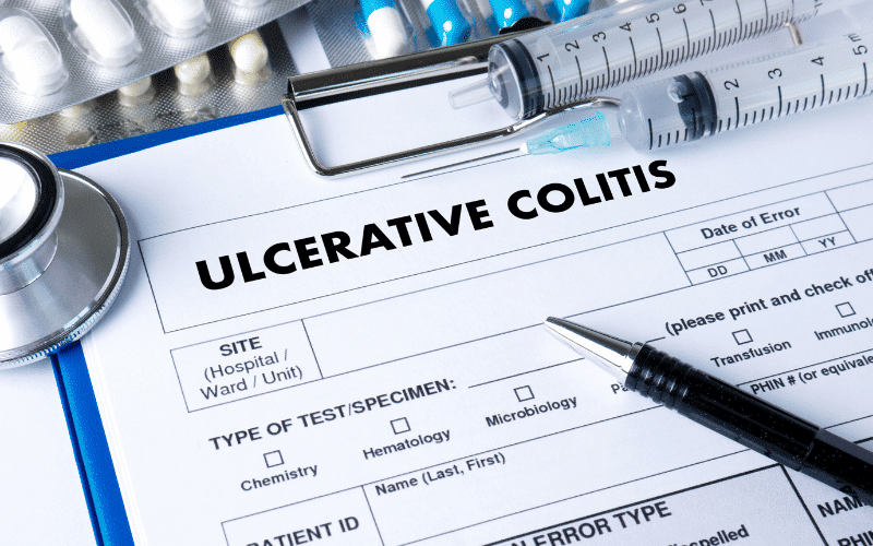 Frequently Asked Questions About Ulcerative Colitis Symptoms in Women