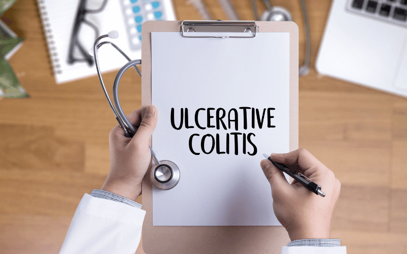 Frequently Asked Questions (FAQs) About Severe Ulcerative Colitis