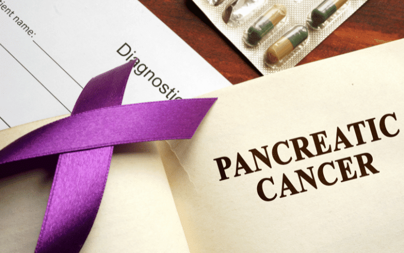 Frequently Asked Questions about Pancreatic Cancer