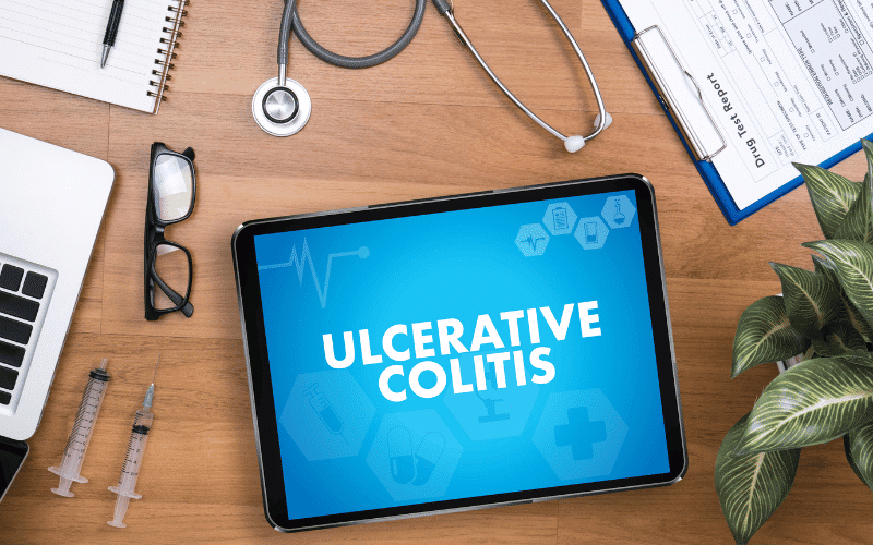 Frequently Asked Questions about Ulcerative Colitis Symptoms in Men