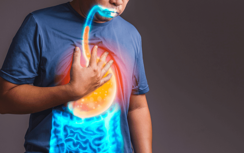 Gastroesophageal Reflux Disease (GERD) A Surprising Culprit