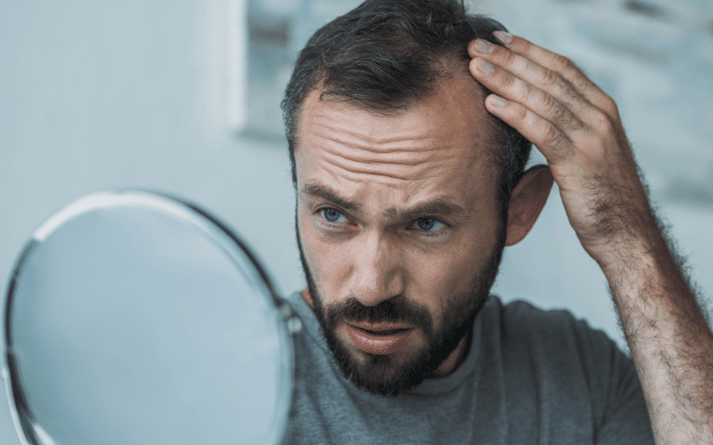 Hair Loss More Than Just Aging