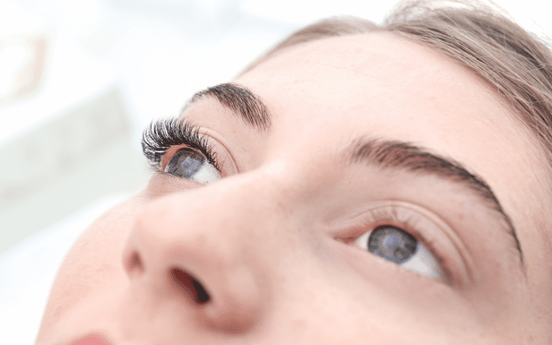 Loss of Eyelashes An Unsettling Consequence of Inflammation