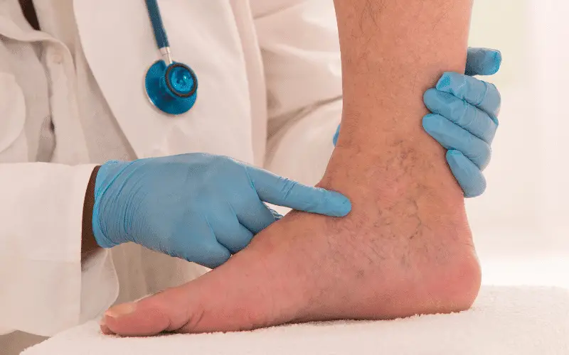Swelling in Your Legs, Ankles, or Feet The Telltale Sign of Fluid Retention