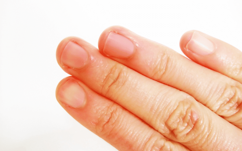 Symptom 9. Decreased Sensation in the Fingertips