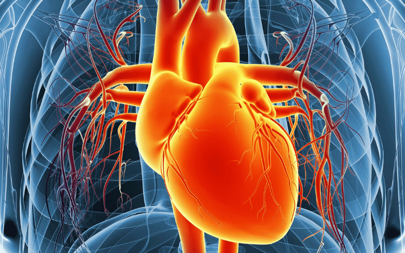 Tertiary Stage Cardiovascular Syphilis