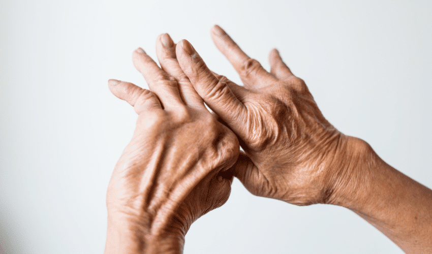 Top 20 Foods to Avoid with Arthritis A MustRead Guide for Joint Health