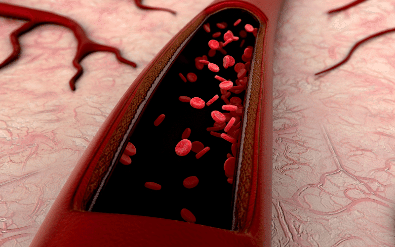 Understanding the 12 Common Types of Vascular Disease