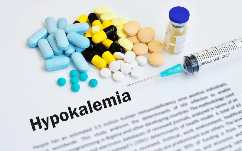 Unraveling the Mystery of Hypokalemia 12 Key Causes and Effective Strategies to Restore Balance