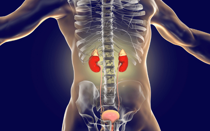 Vesicoureteral Reflux A Backward Flow of Urine