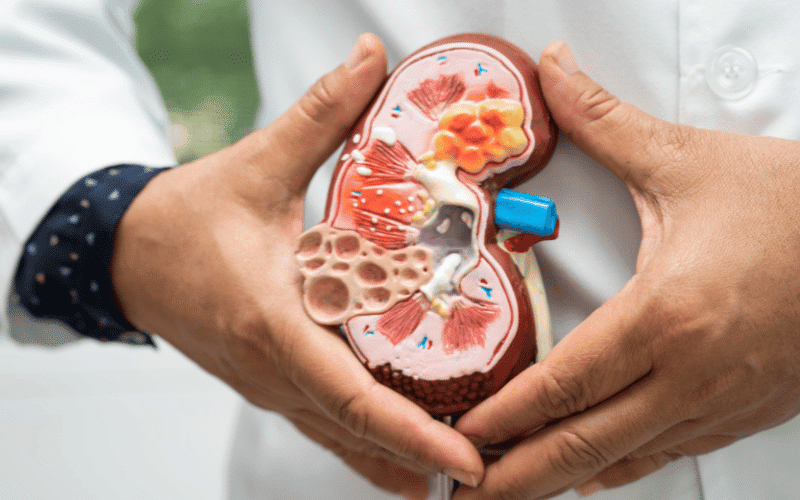 glomerulonephritis