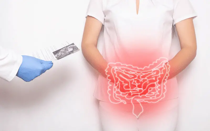 Delineating Ulcerative Colitis and Crohn's Disease Unraveling Six Key Differences