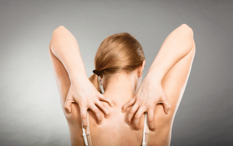 Scratching the Surface Top 10 Causes of Itchy Skin Rashes