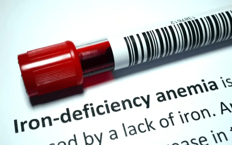 Top 10 Causes of Iron Deficiency Anemia (IDA) That You Need to Know