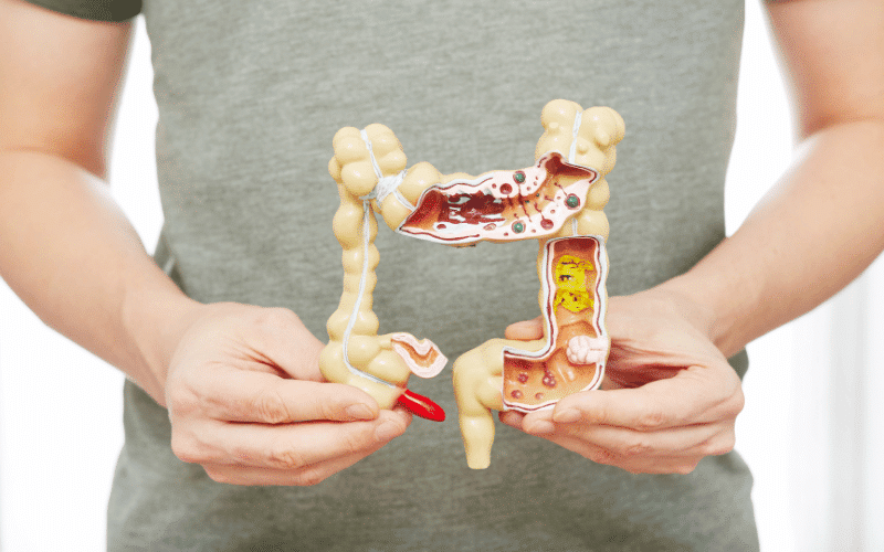 Anatomical Location - The Battlefield of Disease