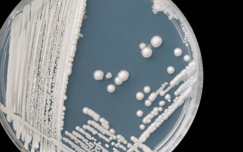 Fungal Infections – The Unseen Attackers