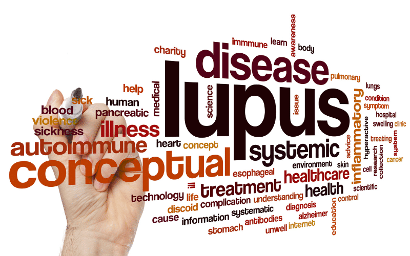 Living with Lupus The Power of Support and Advocacy