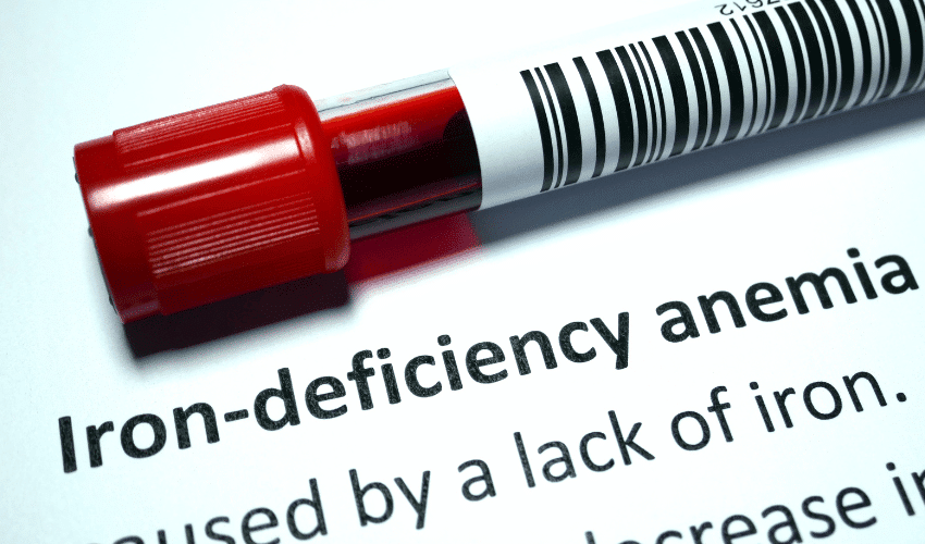 Cause of Hypochromic Microcytic Anemia: Iron-refractory Iron Deficiency Anemia (IRIDA)