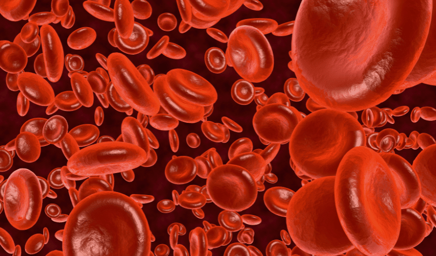 Cause of Hypochromic Microcytic Anemia: Hemoglobinopathies